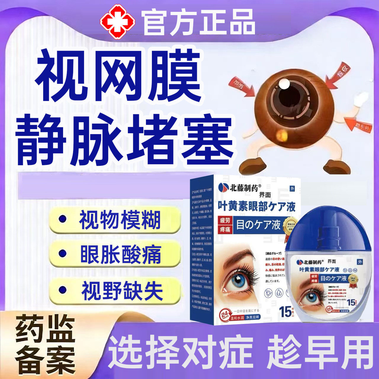 视网膜静脉阻塞眼睛眼底黄斑水肿病变出血可搭视力下降眼药水用PP