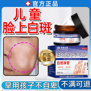 白色糠疹儿童脸上长白斑修复膏小孩汗斑瘙痒皮肤桃花癣护理凝胶WY