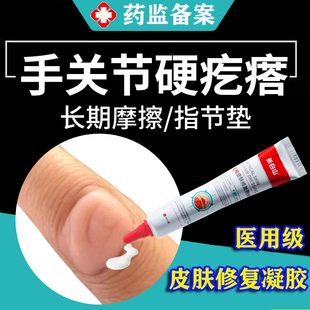 指节垫药膏儿童软化硬皮手上长硬疙瘩癣瘙手指关节茧痒角质增厚MR