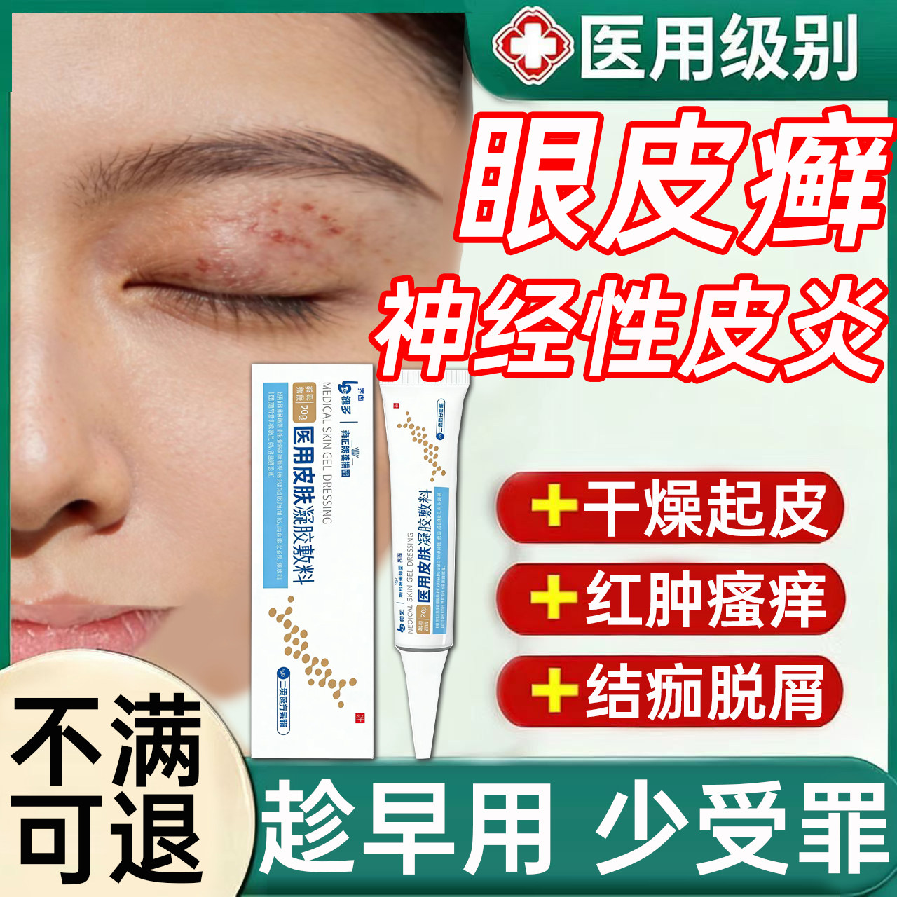 眼皮癣神经性皮炎眼角痒眼睛周围干燥起皮掉屑眼周过敏红肿凝胶UU