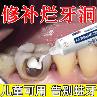 再生硅修复牙膏正品旗舰店清理牙虫的药填充牙洞防蛀牙龋齿儿童UU