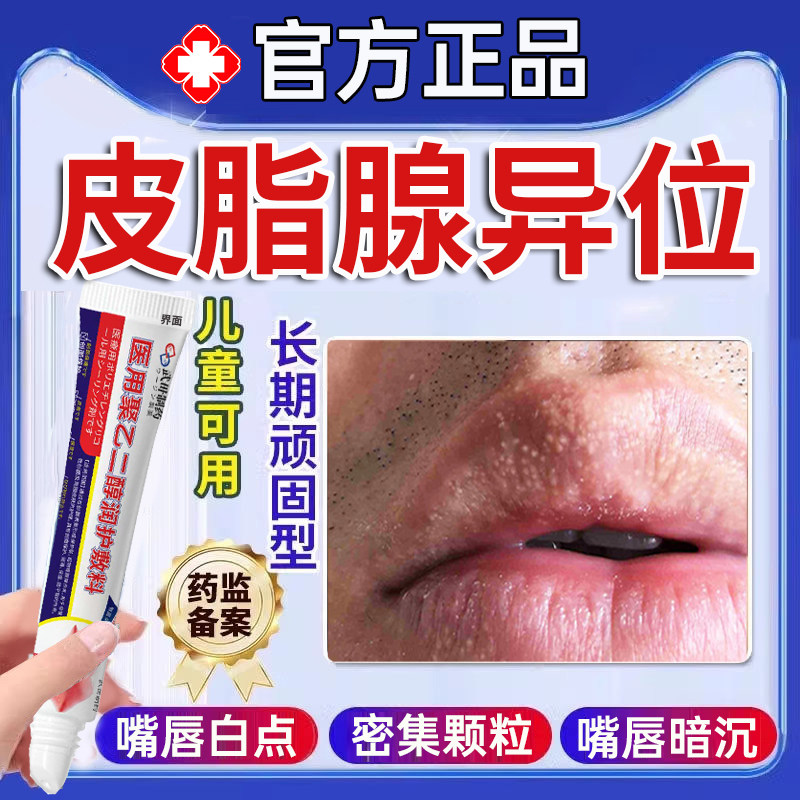 皮脂腺异位症嘴唇白点脂肪小颗粒增生丘疹去唇炎暗沉干裂唇膏PP