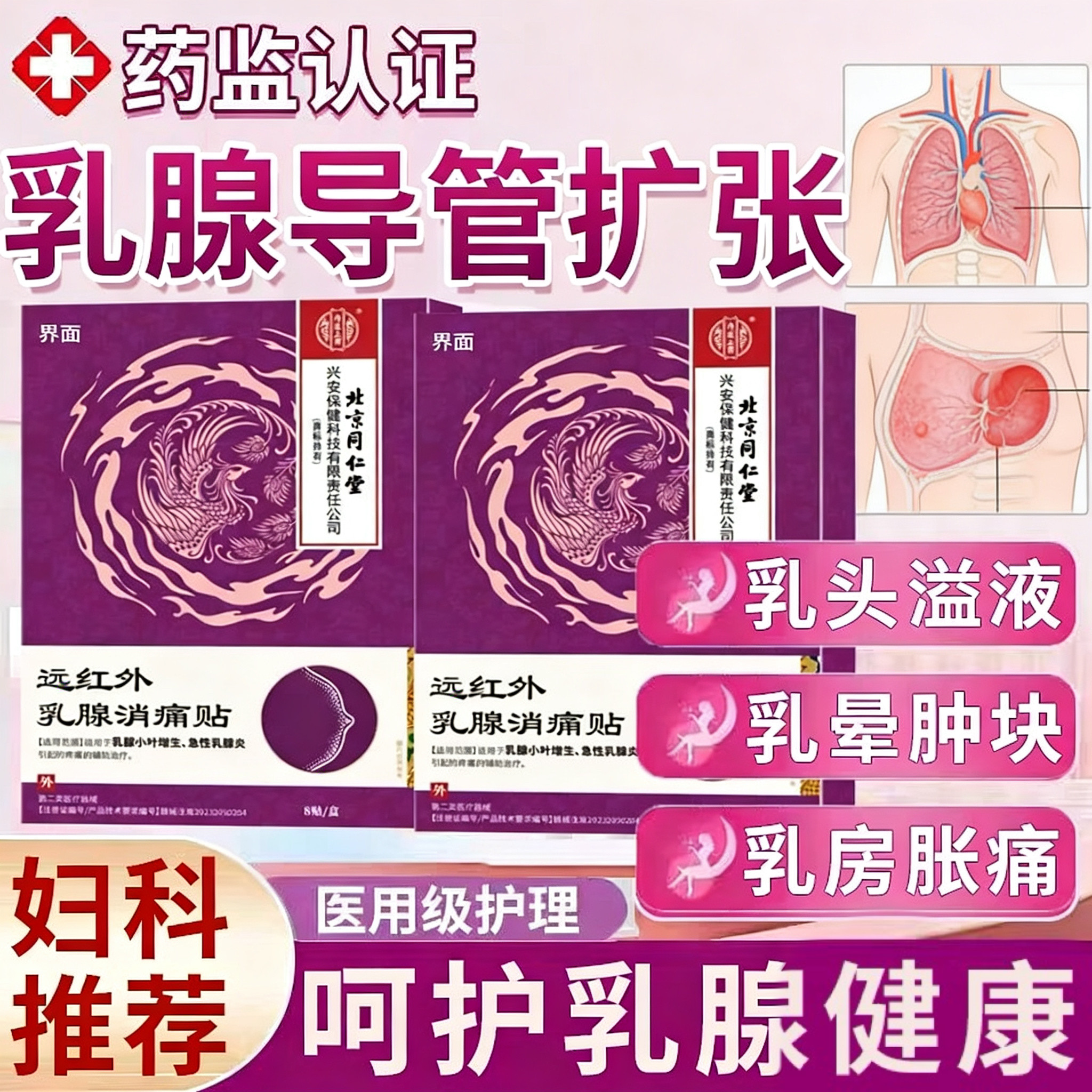 乳腺导管扩张症乳头溢液乳晕肿块浆细胞性乳腺炎结节散结膏药贴PP
