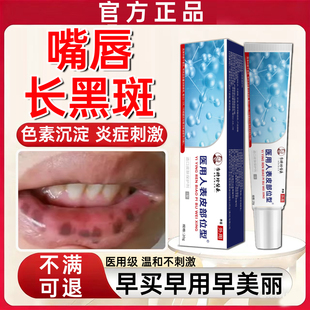 嘴唇黑斑黑点去除修复凝胶唇炎去黑色素沉淀嘴唇部护理淡化黑痣WY
