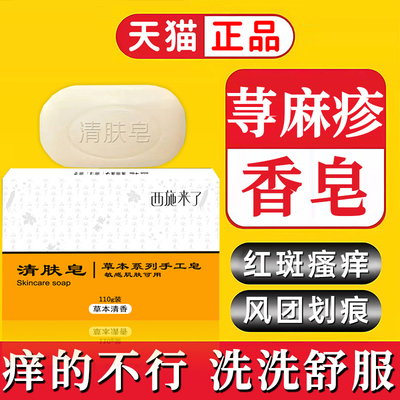 红肿瘙痒过敏疙瘩儿童可用