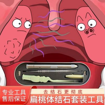 扁桃体结石去除工具吸取器扁导条体结石去除器口腔清理器清除器取