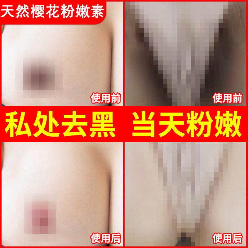 日本嫩红素私处粉嫩乳晕去黑色素乳头护理保养紧致凝胶胸部美白膏
