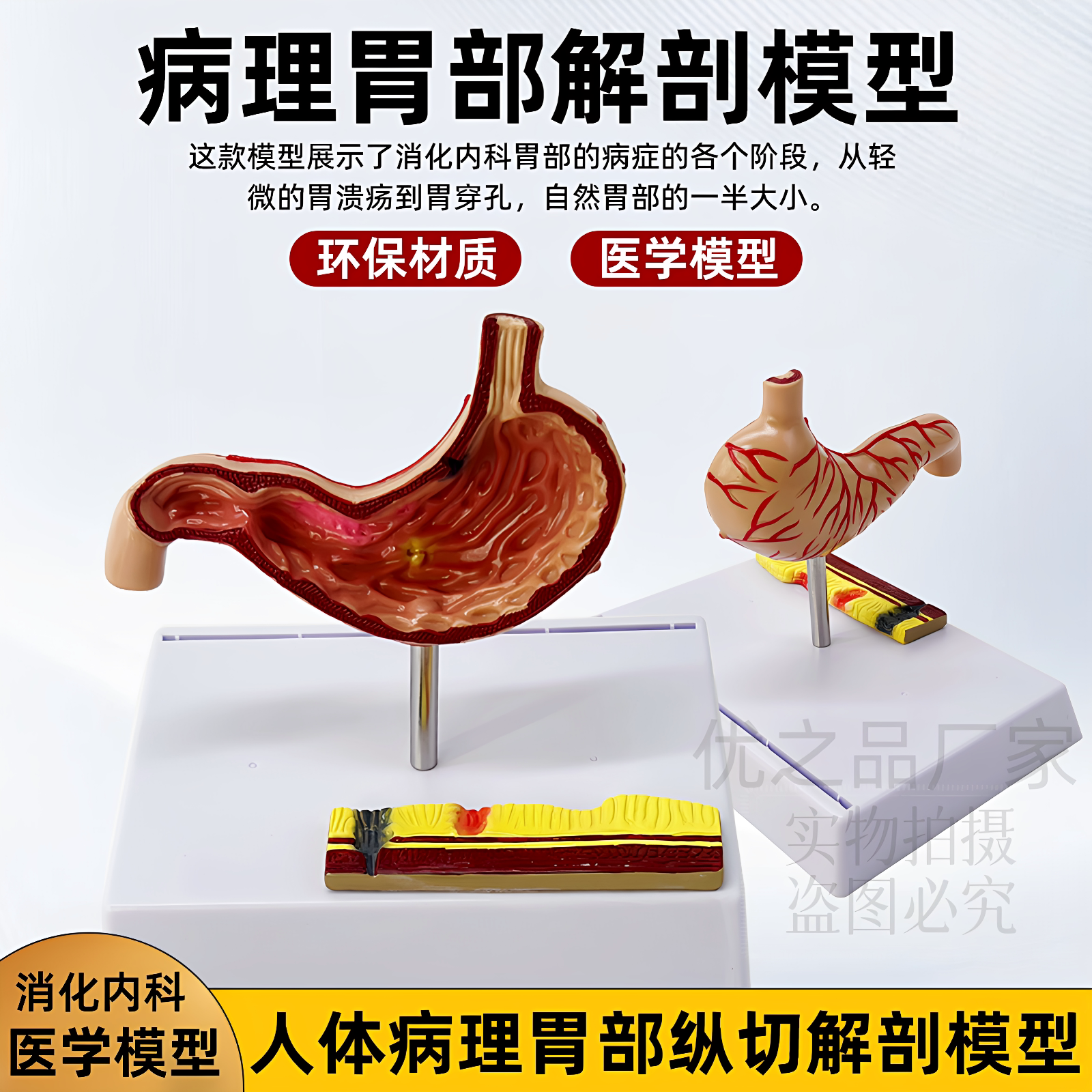 政河人体胃解剖病变穿孔模型医用教学胃穿孔消化演示静态成品模型