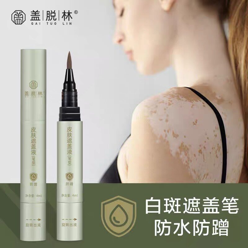 盖脱林白斑遮盖液遮瑕液防水白班遮瑕笔肤色遮瑕膏白斑遮盖笔