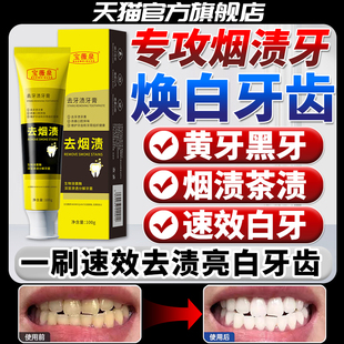 牙膏男士专用去烟渍口臭黄牙双效美清洁白口腔强力茶渍牙垢克星膏