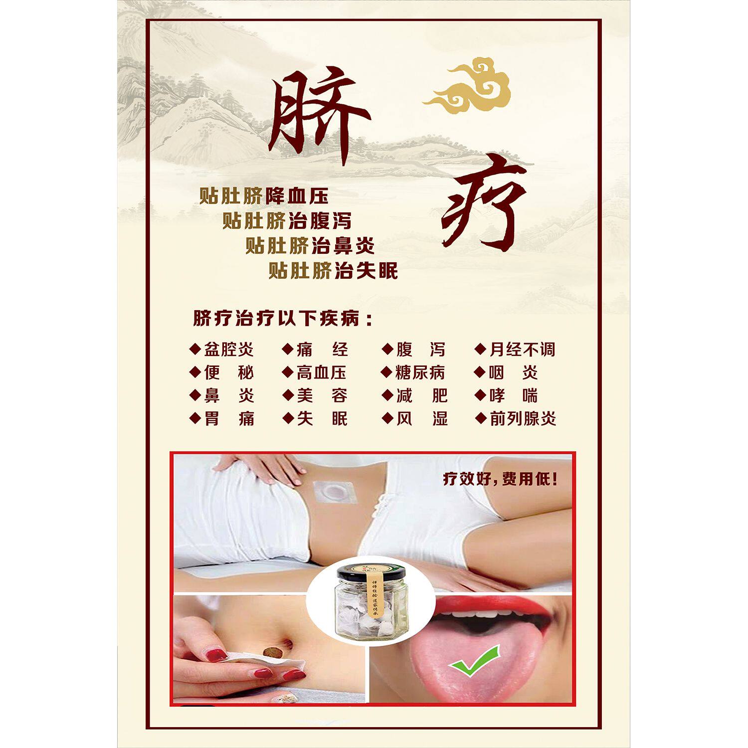 中医养生馆脐疗的好处高清海报贴画脐疗的五大功效自粘广告画包邮