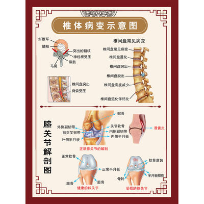 椎体病变膝关节示意图美容院养生海报装饰画贴纸贴画广告画制作