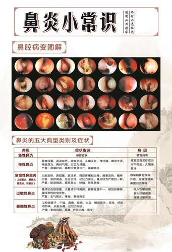鼻炎鼻子小常识墙贴海报挂图