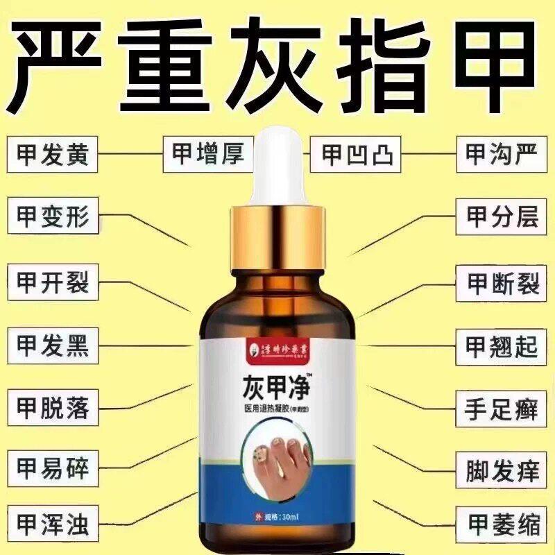正品李时珍灰甲净无痛去
