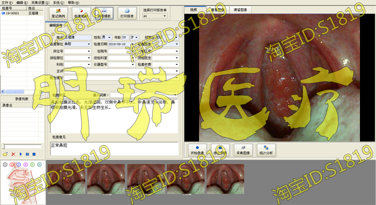 内窥镜软件耳鼻喉镜软件支气管镜软件采集卡脚踏板视频线全套包邮