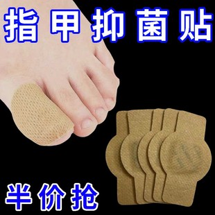 抑菌指甲凝胶脚趾贴修护矫正护理贴一次性透气损伤软甲防传抑菌贴