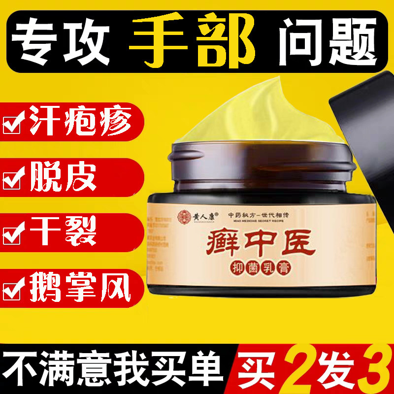 手癣膏手足癣真菌感染脱皮干裂水泡湿疹股藓外用皮肤病止痒脚癣膏