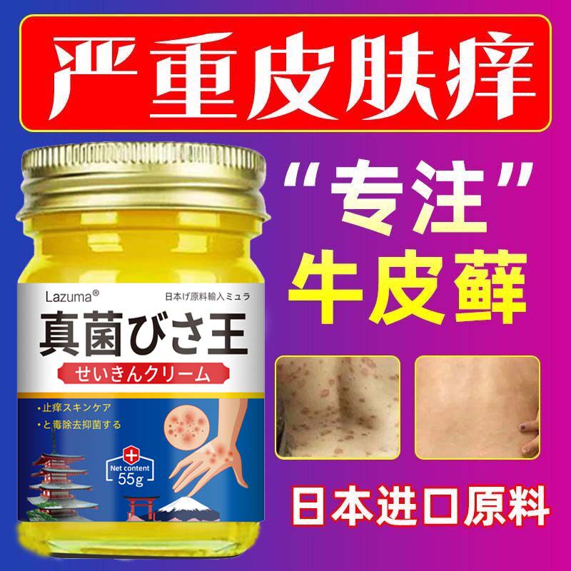 日本真菌王皮肤外用止痒顽固性牛皮体肛门瘙痒膏药专用软膏藓皮肤