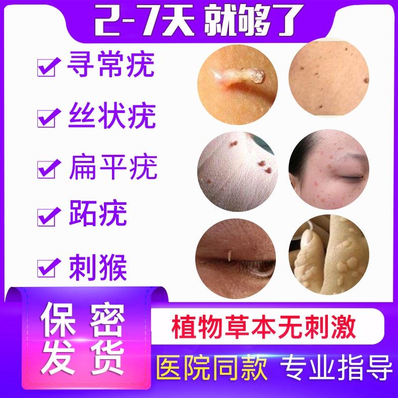 丝状疣图片高清图片-千图网
