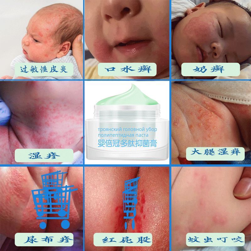 湿疹婴儿专用宝宝奶藓口水疹婴幼儿童热疹凡士林紫草膏身体乳干性