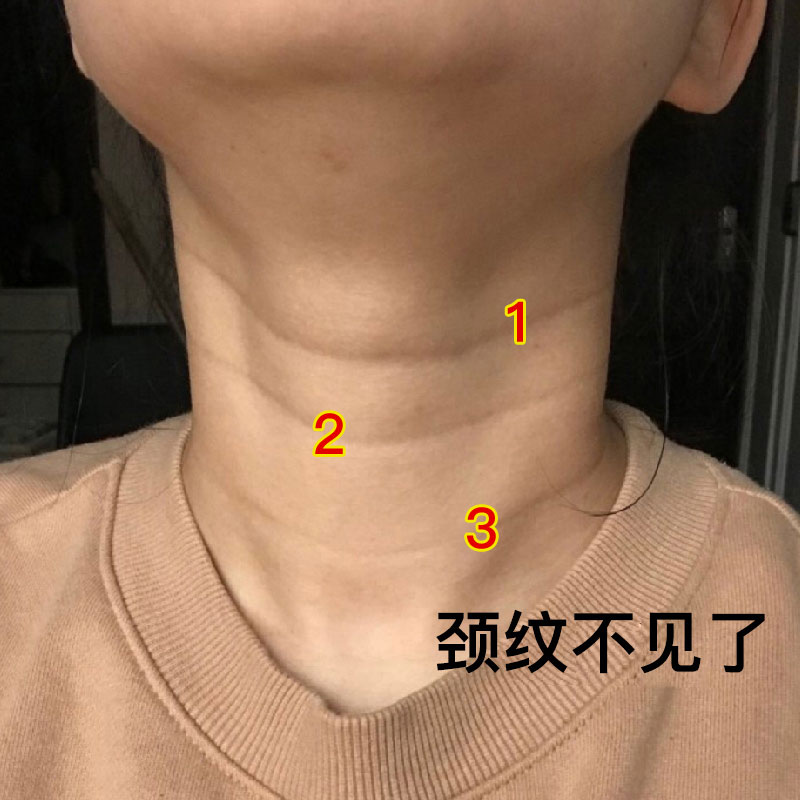 【小红书推荐 去颈纹霜】还你天鹅颈~别让颈纹暴露你的年龄美颈霜