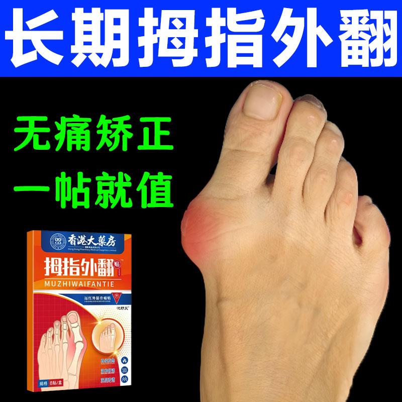 拇指外翻膏贴脚骨关节畸