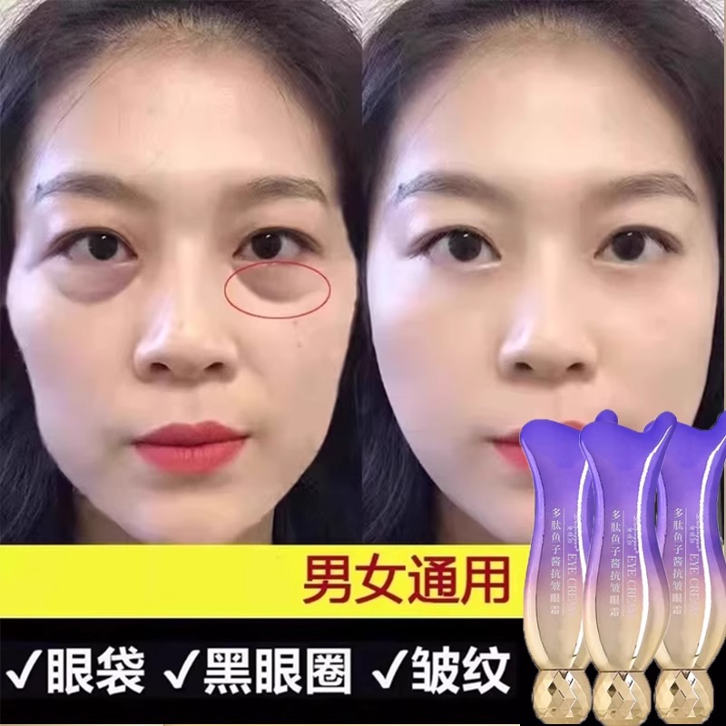 【官方正品】多肽鱼子酱抗皱眼霜淡化黑眼圈细纹去眼袋提拉紧致女