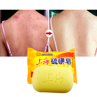 极速10 pcs Shanghai Sulfur Soap AcnEe Psoriasis 4 Skin Condi