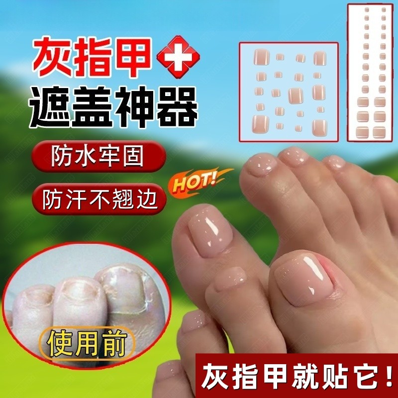 灰指甲遮丑贴夏季凉鞋露脚趾遮盖灰甲贴防汗防水牢固贴手脚足贴女
