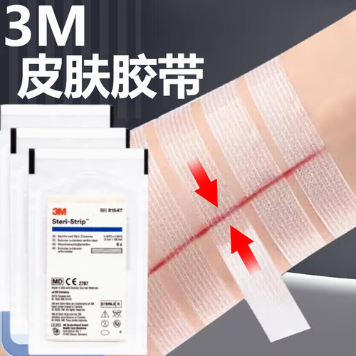 正品保障 药房直售 缝合术后疤痕减张贴