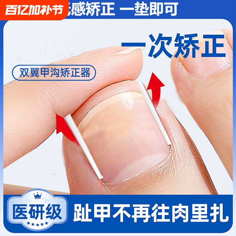 甲沟矫正神器炎指甲矫正器嵌甲正甲垫片脚趾甲往肉里长填充垫棉花