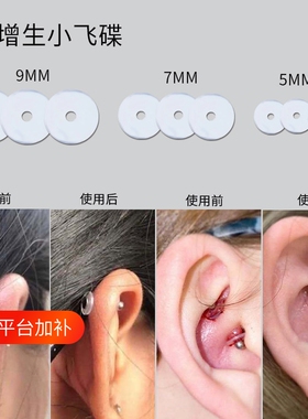 防增生食品级硅胶|379人收藏