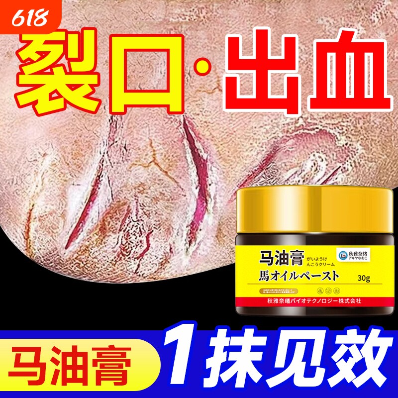 马油膏防裂脚后跟干裂修复霜防开裂冻疮膏手足皲裂膏足跟脚跟冬天