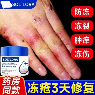 央妈力荐！医用冻疮膏