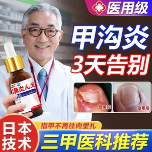 甲沟炎治疗药膏特效嵌甲克星去除息肉软化剂药水指甲消肿去肉芽