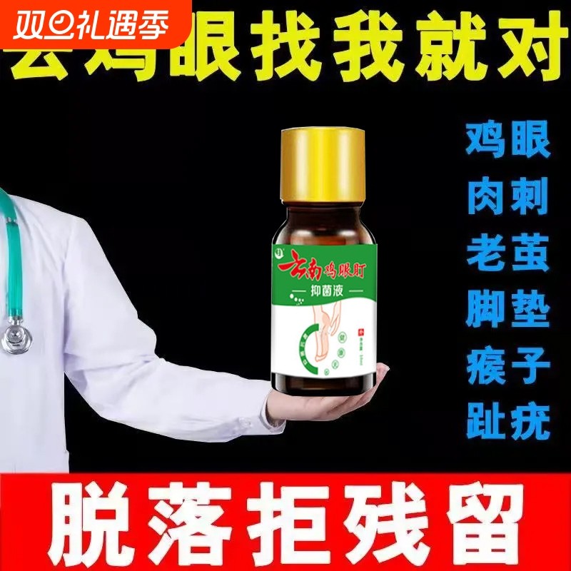 正品鸡眼药水鸡尤平鸡眼膏贴鸡茧眼脚底脚趾手上手足部老茧抑菌液
