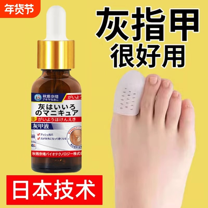 灰指甲专用抑菌液发黄增变厚变硬修剪刀冰醋酸涂剂趾膏正品旗舰店,医疗器械,保健理疗,淘宝优惠券,粉丝福利购,淘宝优惠卷