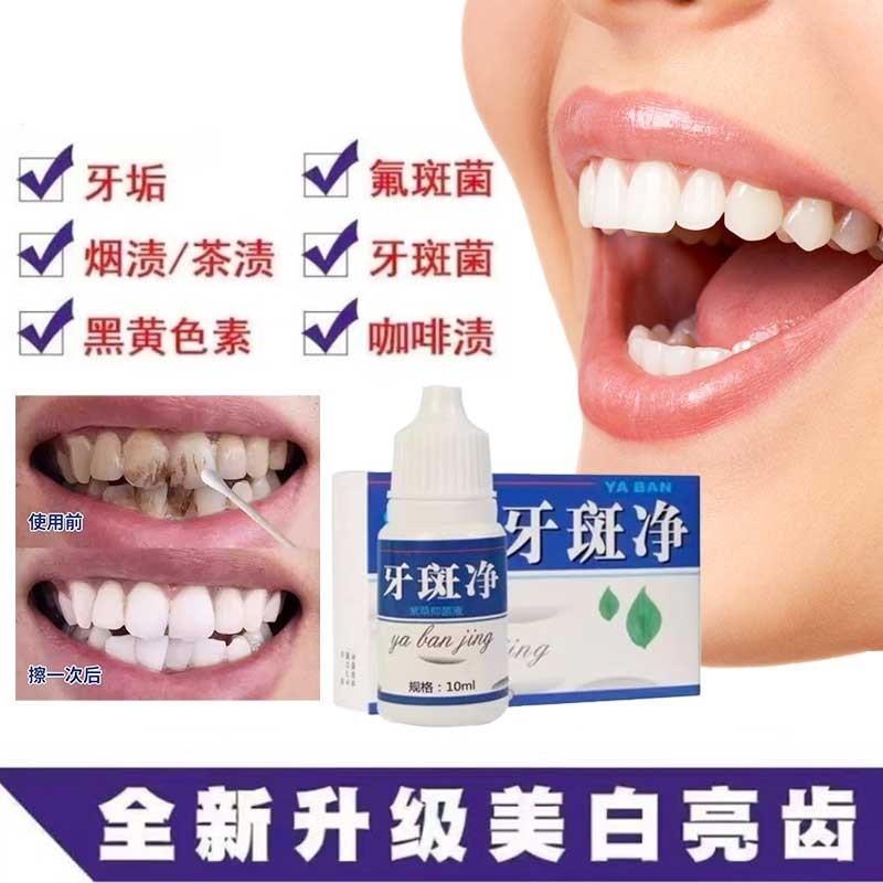 牙斑净牙齿美白速效黄牙去烟渍污垢除牙石牙菌斑祛除清洁神器牙垢