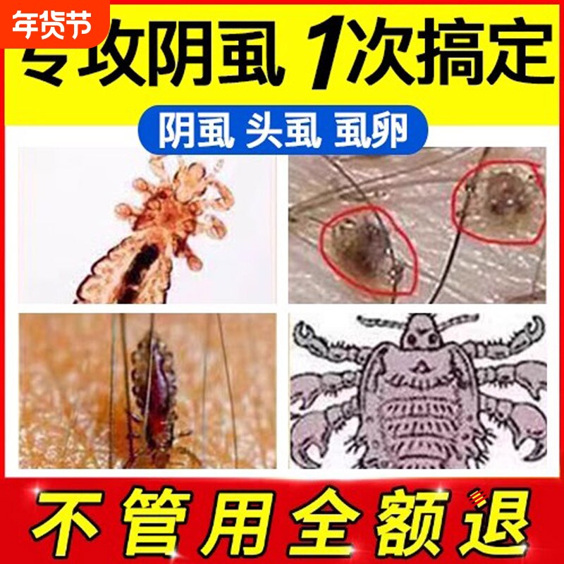 灭阴虱药喷剂女男士用私处虫卵双杀一扫光成人百部酊虱子专用正品