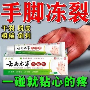 云南本草冻疮膏止痒冻伤膏正品 干痒脚开裂红耳朵皲裂膏