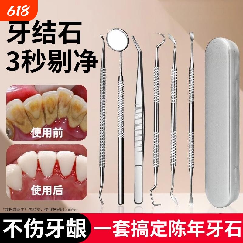 牙结石去除器剔齿神器清理口腔专用工具不锈钢签抠扣刮黄污垢器洁