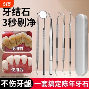 牙结石去除器剔齿神器清理口腔专用工具不锈钢签抠扣刮黄污垢器洁