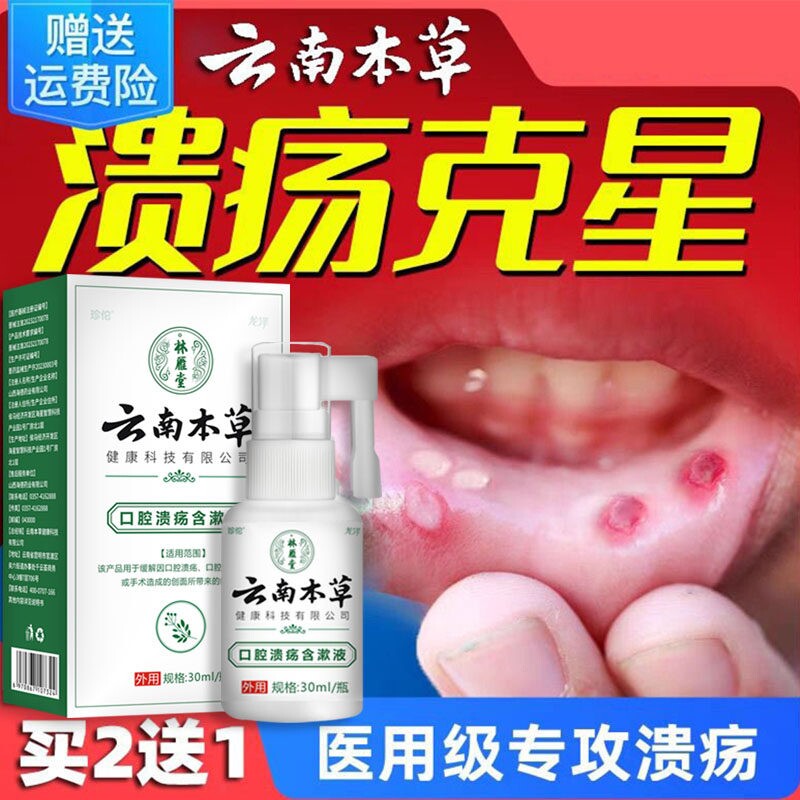 云南本草口腔溃疡专用喷剂复发性口疮含漱液凝胶贴喷雾喷雾剂
