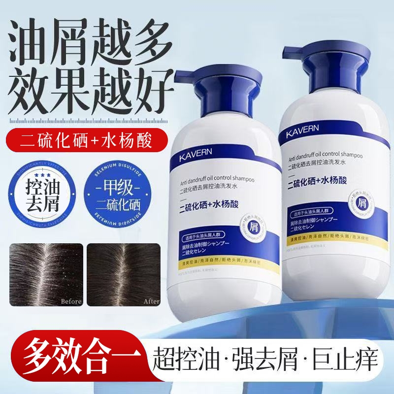 二硫化硒毛囊清洁洗发水去屑止痒除螨控油蓬松炎洗头膏露品牌正品