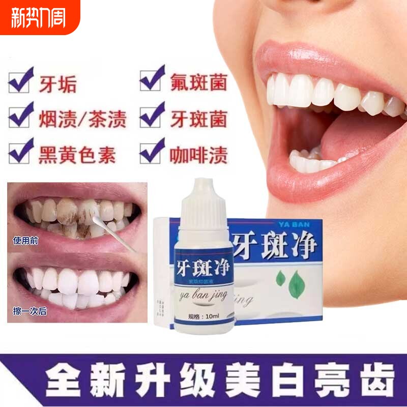 牙斑净牙齿美白速效黄牙去烟渍污垢除牙石牙菌斑祛除清洁神器牙垢