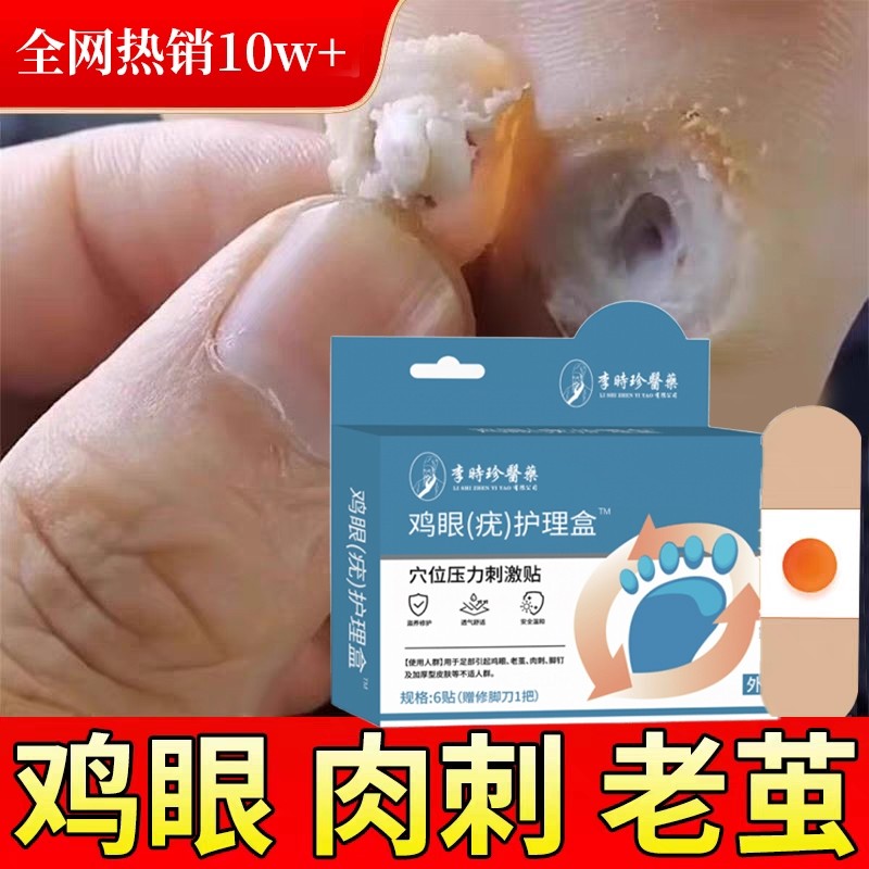 李时珍鸡眼贴鸡眼膏药水瘊子手足部去脚底脚趾部跖疣老茧根肉刺