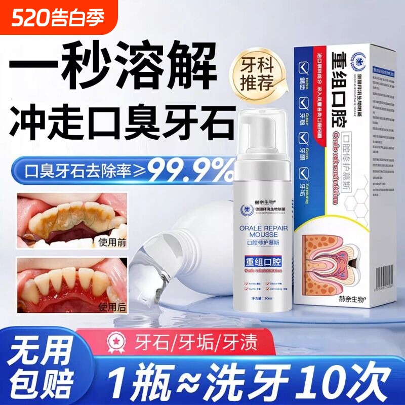 牙结石溶解剂便携漱口水杀菌除去口臭炎持久留香口腔牙周清理医用