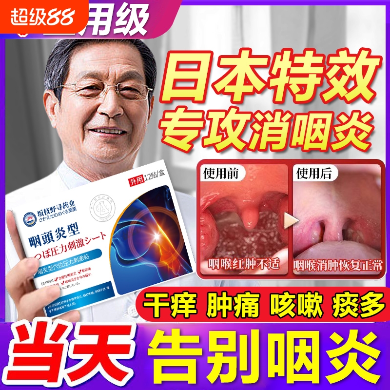 咽喉炎慢性咽炎贴神器除根异物感喉咙肿痛用咽扁桃体肥大止咳贴