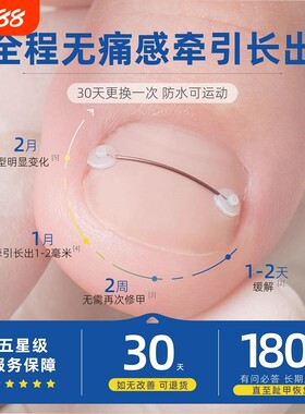 指甲矫正套装|超1000次加购