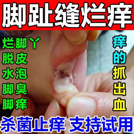 狼毒喷脚王抑菌软膏正品脚汗足部专用草本舒足脚爽脚丫清喷雾喷剂